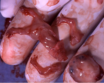 Preciso fazer um aborto